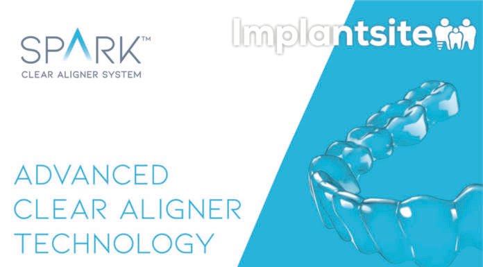 Clínica Dental Implantsite revoluciona la ortodoncia invisible con Spark clínica dental implantsite