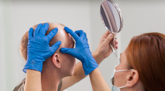 Quirónsalud Infanta Luisa ofrece excelencia en Trasplante Capilar quirónsalud