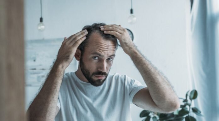 Revolución Capilar: todo lo que debes saber sobre la Cirugía Capilar injerto capilar