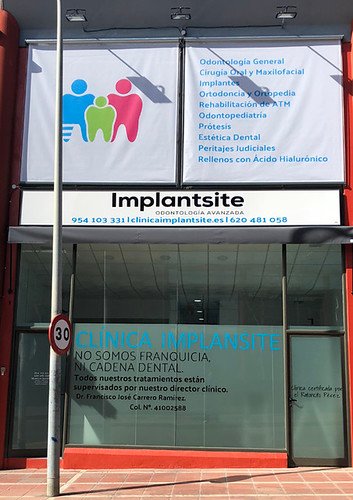 El Método Implantsite siempre vela por el bienestar de sus pacientes